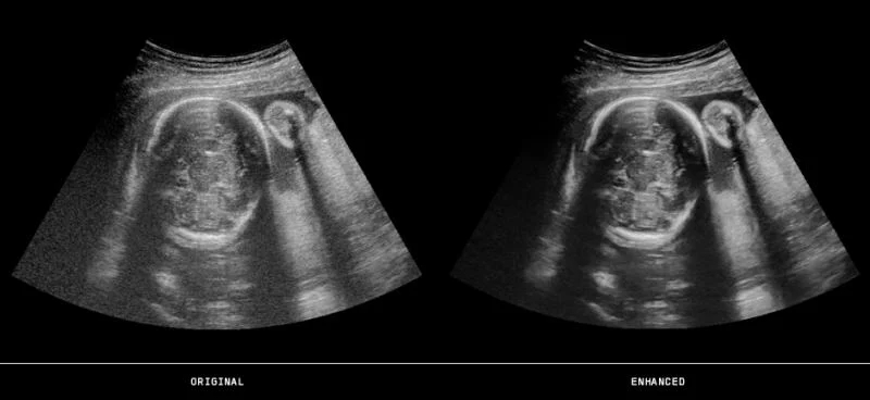 Bogus newborn ultrasound examination tests use to play prank